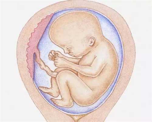代孕可选男女-成都代孕怎么选择性别_移植后宫外孕多久能发现