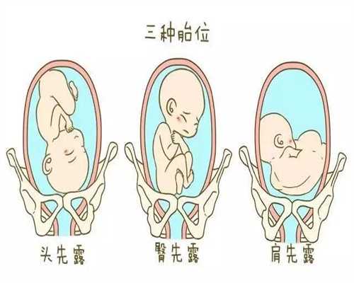 代孕生子-成都代孕哪家比较可靠_婴儿发烧没有别的症状怎么办